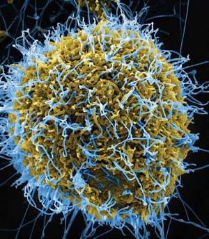 Частицы вируса Эбола…