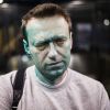 'Шарик сдулся': европейские СМИ о Навальном (Российский оппозиционер Алексей Навальный после нападения на него неизвестных злоумышленников | © AP…) Российский оппозицио…